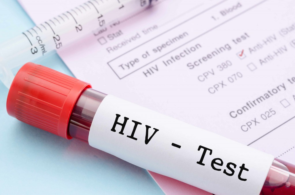 hiv-test